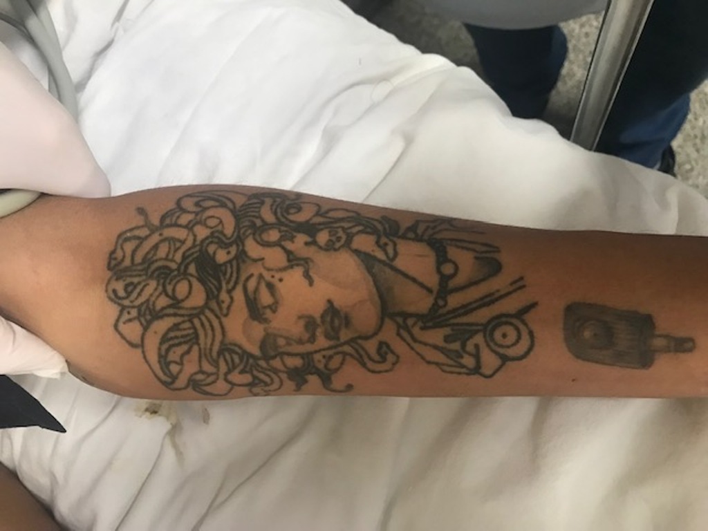 Tatuagens paciente