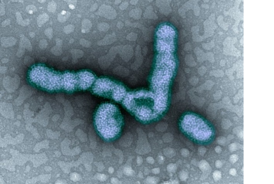 Virus H1N1